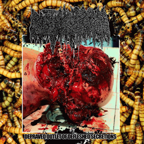 Cystic Hygroma : Depraved Outlet of Defleshed Secretions